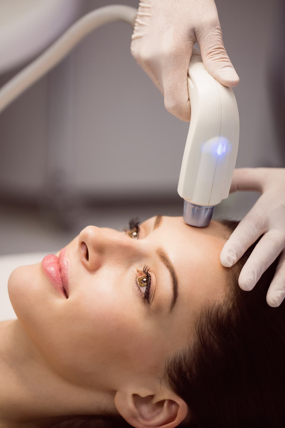 Laser Treatments